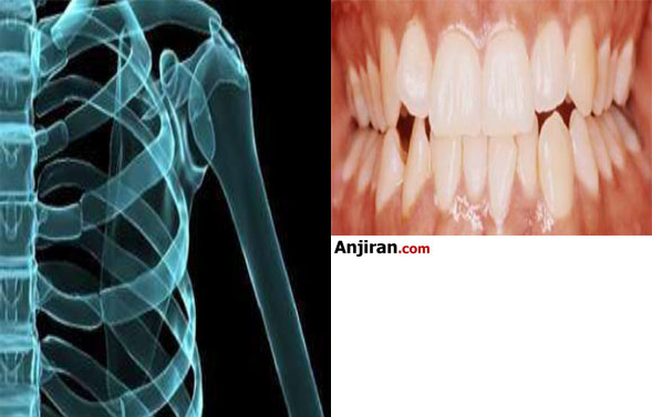 افزایش سلامت استخوان دندان